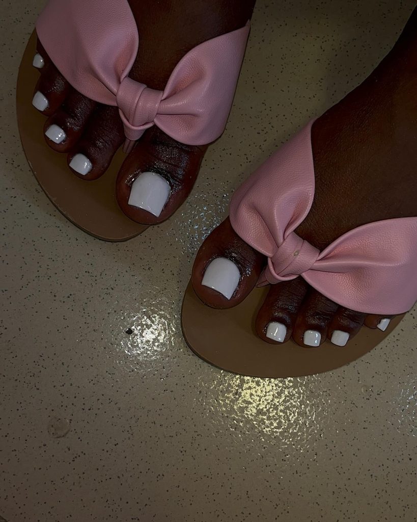 chronicles white toe nails